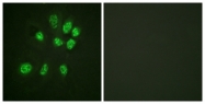 B0922-1 - Estrogen receptor beta