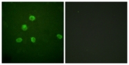 B0930-1 - FOSB