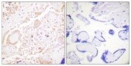 B0933-1 - GATA3