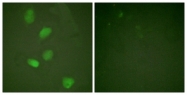 B0939-1 - HDAC3