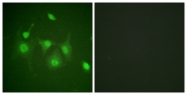 B0941-1 - HDAC6