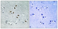 B0941-1 - HDAC6