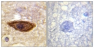 B0952-1 - IFNAR1