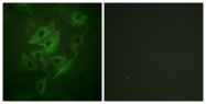 B0959-1 - NMDA Receptor 2A