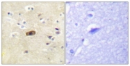 B0959-1 - NMDA Receptor 2A