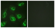 B1024-1 - Calsenilin