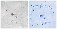 B1088-1 - KCND2