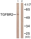 B1127-1 - TGFBR2