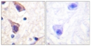 B1127-1 - TGFBR2