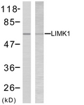 B7141-1 - LIMK2