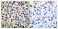C0138-1 - Junction plakoglobin