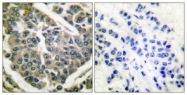 C0157-1 - Collagen type IV