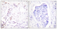 C0166-1 - Cyclin A1