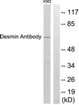 C0171-1 - Desmin