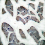 C0171-1 - Desmin