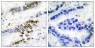 C0184-1 - ERCC1