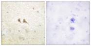 C0189-1 - CD178 / Fas Ligand