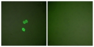 C0203-1 - Galectin-3