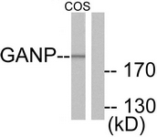 C0204-1 - MCM3AP