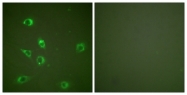 C0206-1 - Glucagon