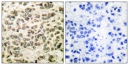 C0224-1 - HDAC3
