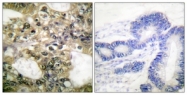 C0226-1 - HDAC6