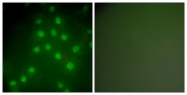 C0228-1 - HDAC9