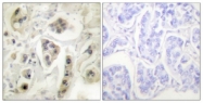 C0233-1 - HSP60