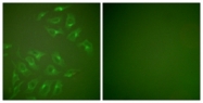 C0265-1 - MMP-13