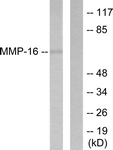 C0268-1 - MMP-16