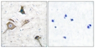 C0268-1 - MMP-16