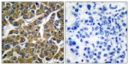 C0272-1 - MMP-3