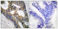 C0273-1 - MMP-7