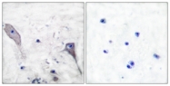 C0296-1 - PTCH1