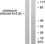 C0307-1 - KCNC2