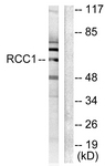 C0314-1 - RCBTB1