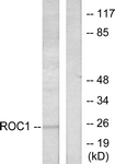 C0317-1 - RIT1