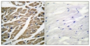 C0327-1 - SCN1A