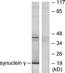 C0334-1 - Gamma-Synuclein / SNCG