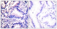 C0334-1 - Gamma-Synuclein / SNCG