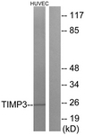 C0349-1 - TIMP3