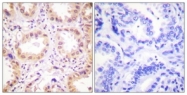 C0359-1 - NEDD8