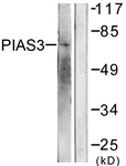 C0363-1 - PIAS3