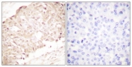 C0365-1 - SENP1