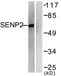 C0366-1 - SENP2