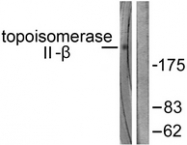 C0376-1 - TOP2B