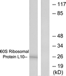 C0391-1 - RPL10