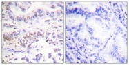 C0397-1 - XRCC3