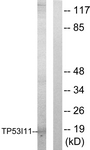 C10041-1 - TP53I11