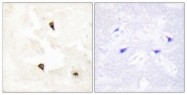 C10041-1 - TP53I11